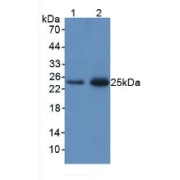 Western blot analysis of (1) Rat Lung Tissue and (2) Rat Spleen Tissue.