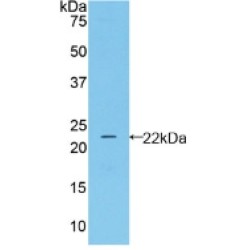 Neutrophil Gelatinase Associated Lipocalin / NGAL (LCN2) Antibody