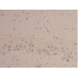 Neutrophil Gelatinase Associated Lipocalin / NGAL (LCN2) Antibody
