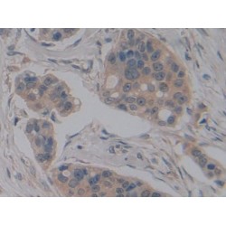 Nitric Oxide Synthase Interacting Protein (NOSIP) Antibody