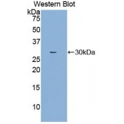 Western blot analysis of recombinant Human NOSIP.