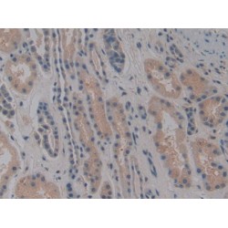 Nitric Oxide Synthase Interacting Protein (NOSIP) Antibody