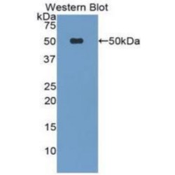 Platelet-Activating Factor Acetylhydrolase (PLA2G7) Antibody