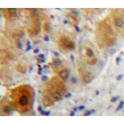 Platelet-Activating Factor Acetylhydrolase (PLA2G7) Antibody