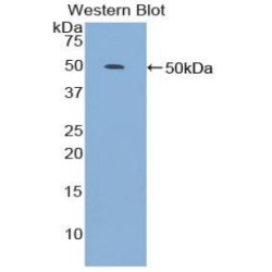 Platelet-Activating Factor Acetylhydrolase (PLA2G7) Antibody