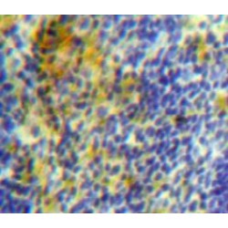 Platelet-Activating Factor Acetylhydrolase (PLA2G7) Antibody