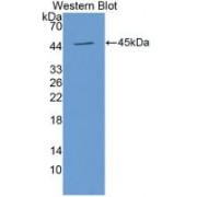 Western blot analysis of recombinant Human ALCAM.