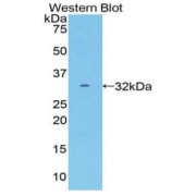 Western blot analysis of the recombinant protein.