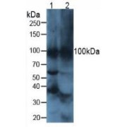 Western blot analysis of (1) Mouse Heart Tissue and (2) Mouse Brain Tissue.