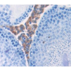 Bactericidal Permeability-Increasing Protein (BPI) Antibody