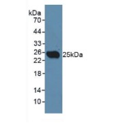 Western blot analysis of Rat Testis Tissue.