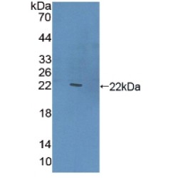 C-Type Lectin Domain Family 10 Member A / CD301 (CLEC10A) Antibody