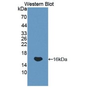 Western blot analysis of the recombinant protein.