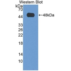 Hepatocellular Carcinoma Related Protein 1 (HCRP1) Antibody