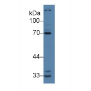 Western blot analysis of Human K562 cell lysate, using Human IRAK2 Antibody (2 µg/ml) and HRP-conjugated Goat Anti-Rabbit antibody (<a href="https://www.abbexa.com/index.php?route=product/search&amp;search=abx400043" target="_blank">abx400043</a>, 0.2 µg/ml).