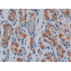 Interleukin 1 Receptor Associated Kinase 2 (IRAK2) Antibody