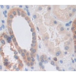 Interleukin 1 Receptor Associated Kinase 3 (IRAK3) Antibody