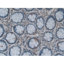 Lysophosphatidylcholine Acyltransferase 3 (LPCAT3) Antibody