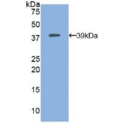Mitogen-Activated Protein Kinase Kinase 1 (MAP2K1) Antibody