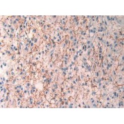 Mitogen-Activated Protein Kinase Kinase 1 (MAP2K1) Antibody