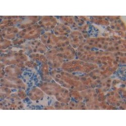 Mitogen-Activated Protein Kinase Kinase 2 (MAP2K2) Antibody