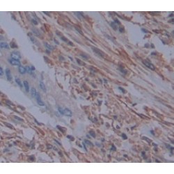 Mitogen-Activated Protein Kinase Kinase 4 (MAP2K4) Antibody