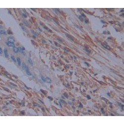 Mitogen-Activated Protein Kinase Kinase 4 (MAP2K4) Antibody