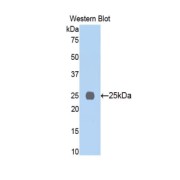 Western blot analysis of the recombinant protein.