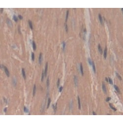 Myosin Light Chain 1, Alkali, Fast Skeletal (MYL1) Antibody