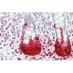 Regenerating Islet Derived Protein 3 Alpha (REG3a) Antibody