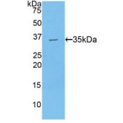 Western blot analysis of recombinant Human CPB2/TAFI.