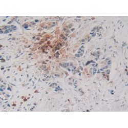 Carboxypeptidase B2 / TAFI (CPB2) Antibody