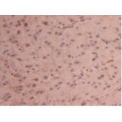 Carboxypeptidase B2 / TAFI (CPB2) Antibody