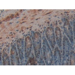 Carboxypeptidase B2 (CPB2) Antibody