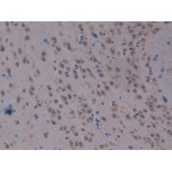 Carboxypeptidase B2 (CPB2) Antibody
