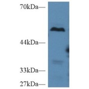 WB analysis of Mouse liver tissue lysate, using Carboxypeptidase B2 (CPB2) Antibody (2 µg/ml) and HRP-conjugated Goat Anti-Rabbit antibody (<a href="https://www.abbexa.com/index.php?route=product/search&amp;search=abx400043" target="_blank">abx400043</a>, 0.2 µg/ml).