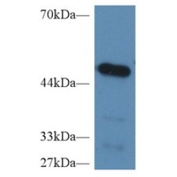 Carboxypeptidase B2 (CPB2) Antibody