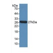 Western blot analysis of recombinant Human TPT1.