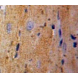 Tumor Protein, Translationally Controlled 1 (TPT1) Antibody