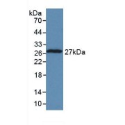 Western blot analysis of recombinant Human TPT1.