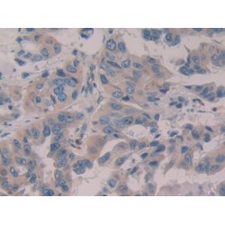 WNT1 Inducible Signaling Pathway Protein 1 / WISP1 (CCN4) Antibody