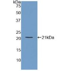 Actin Related Protein 2/3 Complex Subunit 4 (ARPC4) Antibody