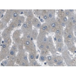 Actin Related Protein 2/3 Complex Subunit 4 (ARPC4) Antibody