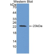 Western blot analysis of the recombinant protein.