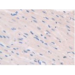 Caspase Recruitment Domain Family, Member 9 (CARD9) Antibody