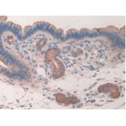 Caspase Recruitment Domain Family, Member 9 (CARD9) Antibody