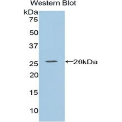 Coagulation Factor VIII Associated Protein 1 (F8A1) Antibody