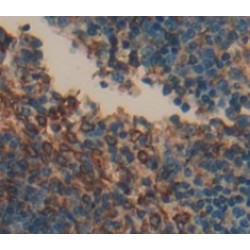 Colony Stimulating Factor 2 Receptor Alpha (CSF2Ra) Antibody