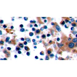 Cytotoxic T-Lymphocyte Associated Antigen 4 (CTLA4) Antibody