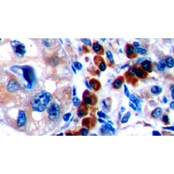 Cytotoxic T-Lymphocyte Associated Antigen 4 (CTLA4) Antibody